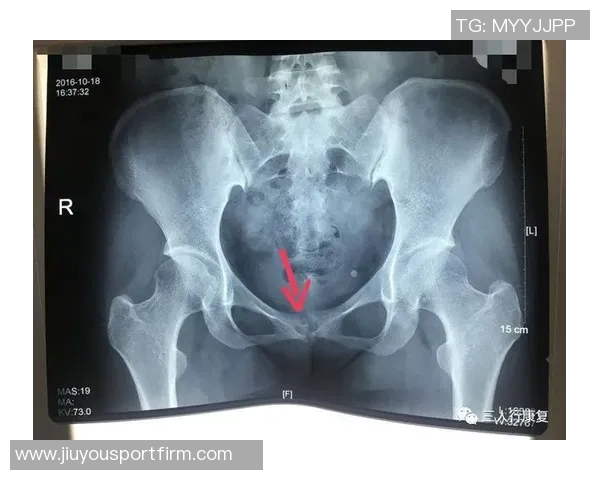 尼科威廉姆斯谈耻骨炎恢复过程并表示需带伤出战的挑战与决心